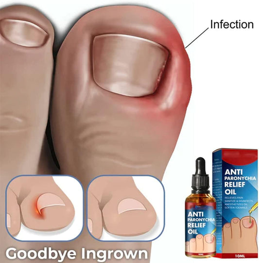 HealDrop™ – Herstelt beschadigde, broze nagels effectief in slechts 4 weken [1 + 1 Gratis]