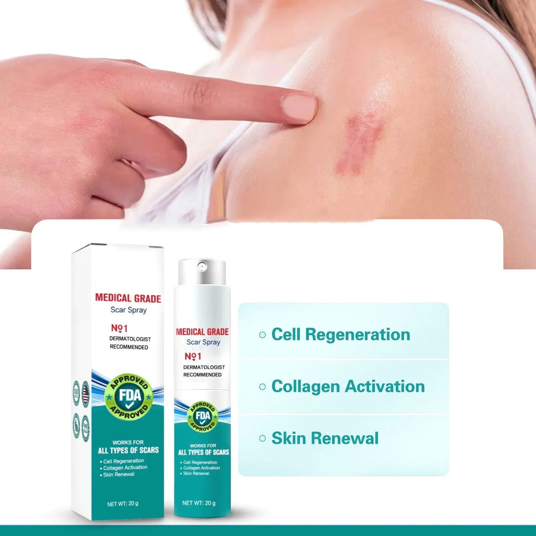 ScarRelief™ – Littekenspray voor Acne, Striae & Operatielittekens