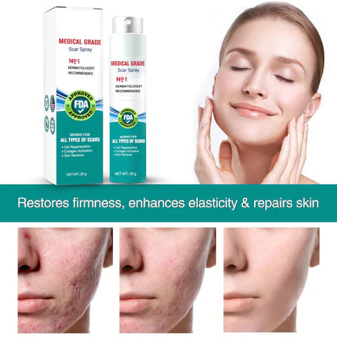 ScarRelief™ – Littekenspray voor Acne, Striae & Operatielittekens