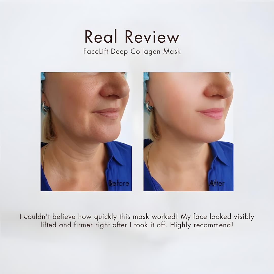 HydraLift™ – Directe huidverstrakking [50% Korting]