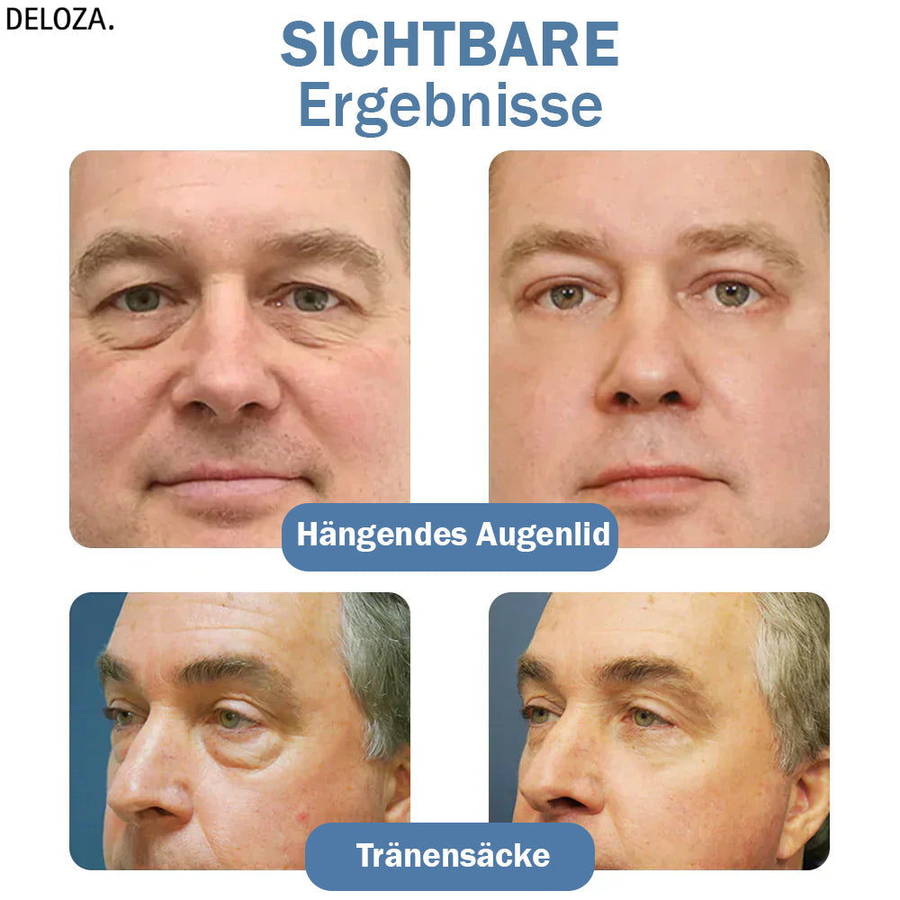 EyeTouch – Verstevigend Oogverzorging voor Jeugdig Frisse Ogen [50% Korting]