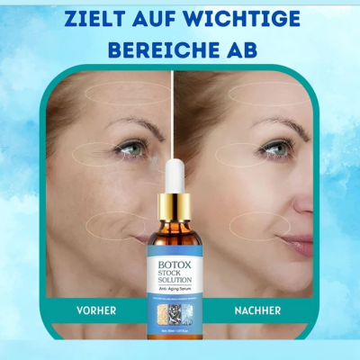 YouthGlow™ – Botox-vrij anti-aging serum voor stralende, jeugdige huid [1 + 1 Gratis]