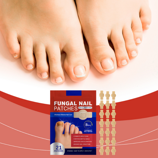 FungalPatch™ – Antibacteriële, schimmelwerende patch voor effectieve nagelverzorging [50% Korting]