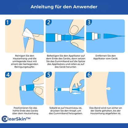 ClearSkin™ Wrattenverwijderaar Pen – Pijnvrije & Snelle Huidbehandeling