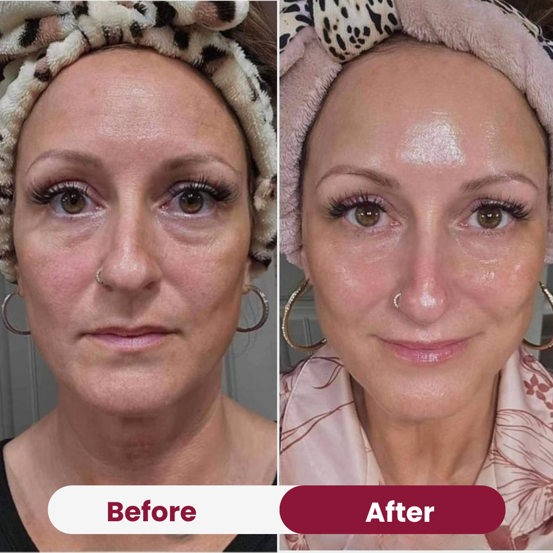 Nifora™ – Intensief Verzorgend Masker voor Jeugdige, Stralende Huid [1 + 1 Gratis]