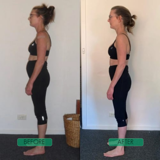 AlignPro™ – Voel je de Hele Dag Sterk en Rechtop [50% Korting]