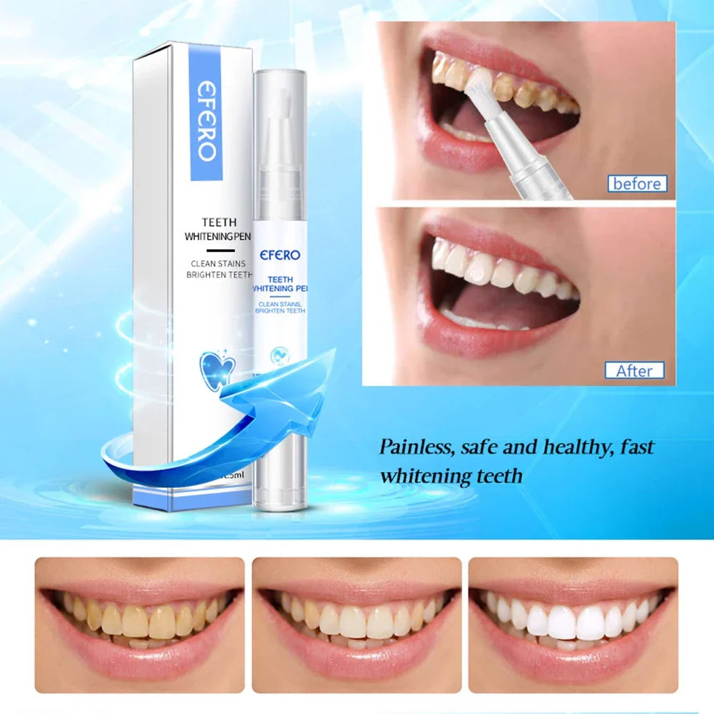 1 + 1 Gratis | Brighten™ - Witte tanden in seconden [Laatste dag korting]