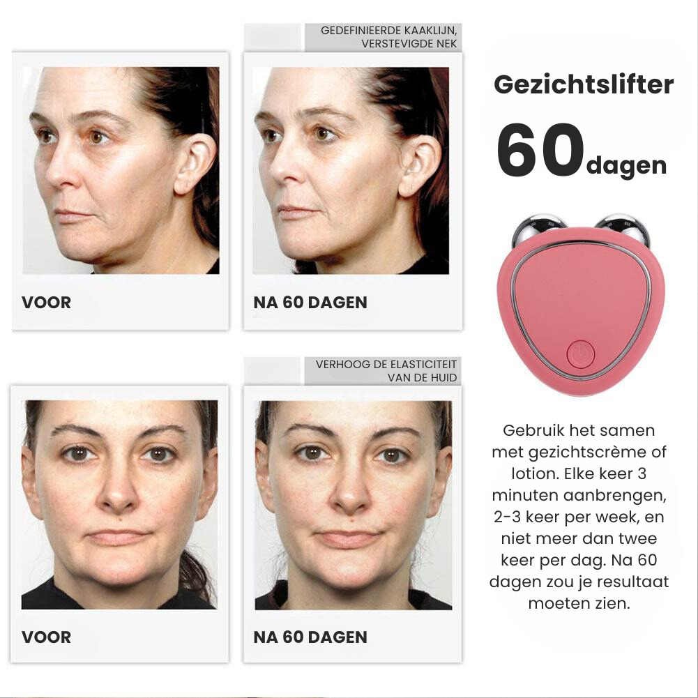 SkinVivo™ -Gezichtsmassageapparaat [50% Korting]