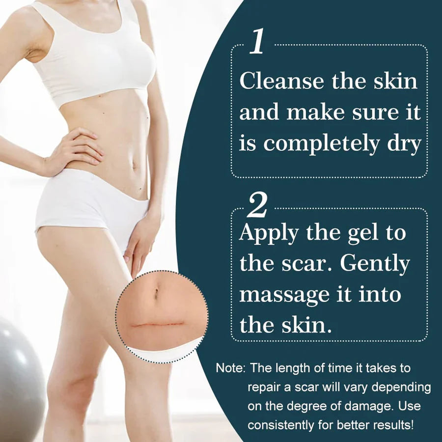 ScarAway™ – Geavanceerde littekenverwijderingsgel voor een gladde huid [1 + 1 Gratis]