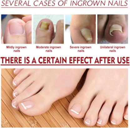 HeilungsTropfen™ – Beschadigde & Broze Nagels Herstellen in 4 Weken [1+1 Gratis]