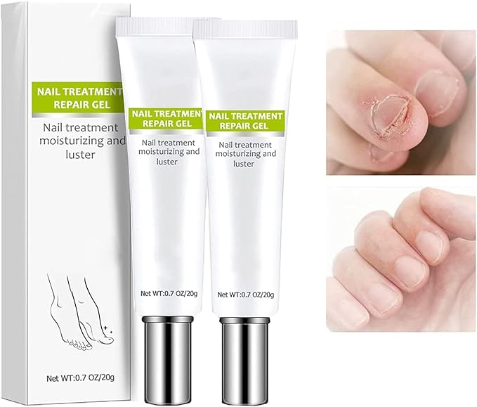 RejuveNail™ – Nagelgel tegen Schimmel & Broze Nagels [1 + 1 Gratis]