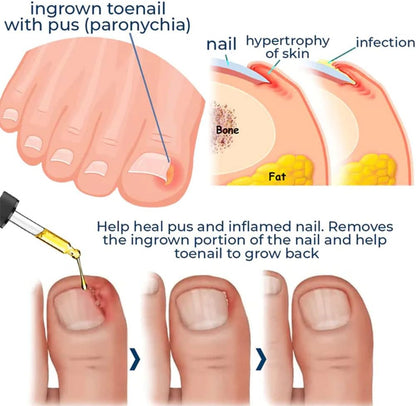 HealDrop™ – Herstelt beschadigde, broze nagels effectief in slechts 4 weken [1 + 1 Gratis]