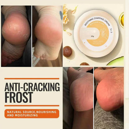 SkinShiner™ – Intensieve verzorging voor droge huid voor herstel en regeneratie [1 + 1 Gratis]