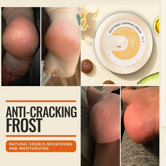 HydraHeel™ – Verzorgende en kalmerende crème voor dagelijkse verlichting [1 + 2 Gratis]