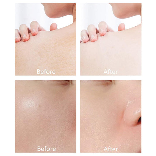 Derol™ – Voor jeugdige glow-boost en een stralende, gezond uitziende huid [1 + 1 Gratis]