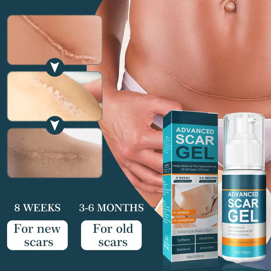 ScarGel™ - Zachte littekenverzorging voor een zichtbaar gladdere huid. [1 + 1 Gratis]
