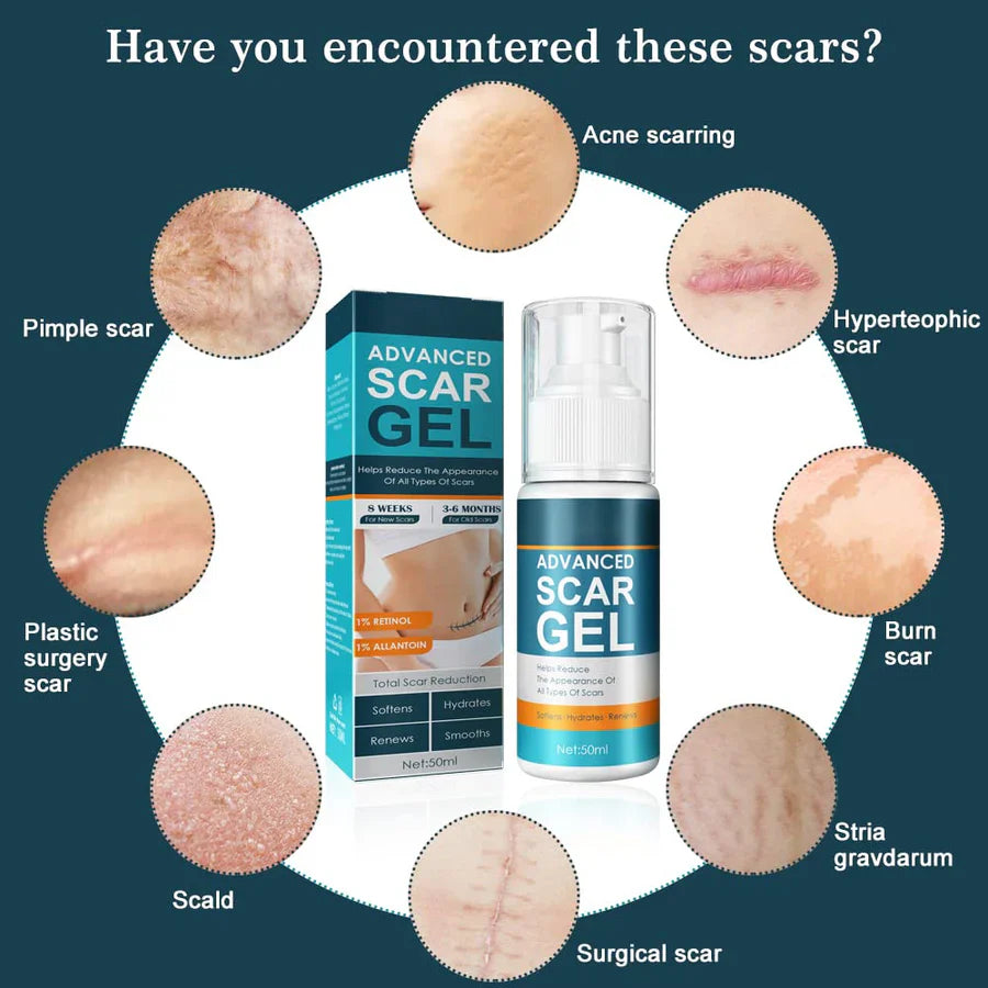 ScarAway™ – Geavanceerde littekenverwijderingsgel voor een gladde huid [1 + 1 Gratis]