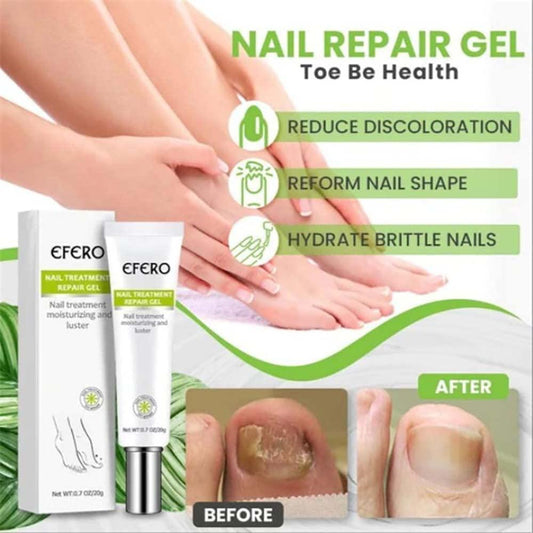 RejuveNail™ – Versterkt je nagels voor een gezonde & mooie uitstraling [1 + 1 Gratis]