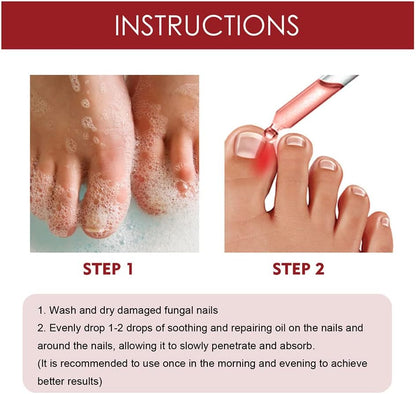 HealDrop™ – Herstelt beschadigde, broze nagels effectief in slechts 4 weken [1 + 1 Gratis]