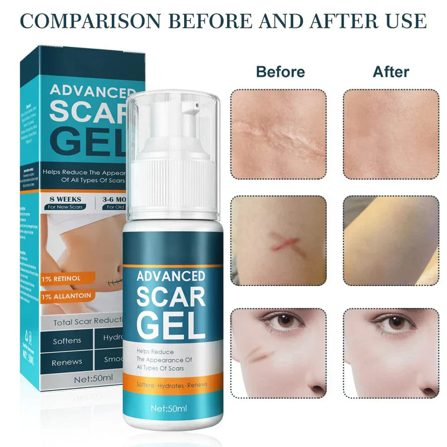 ScarGel™ - Littekens vervagen mooi. [1 + 1 Gratis]