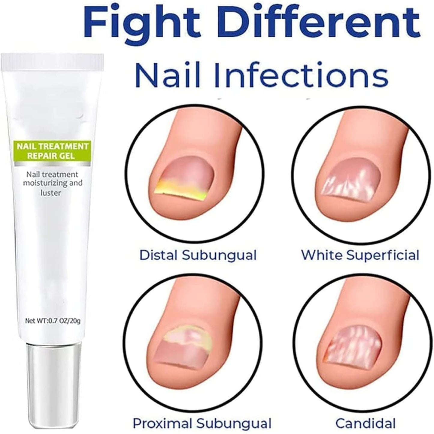 RejuveNail™ – Versterkt Duurzaam Gezonde, Mooie Nagels [1 + 1 Gratis]