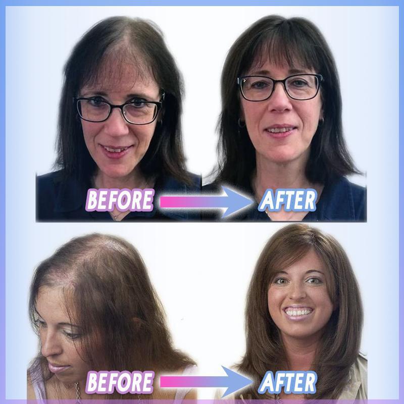 MagicHair™ – Magische clip-on haarelastiek voor moeiteloze, stijlvolle styling [50% Korting]