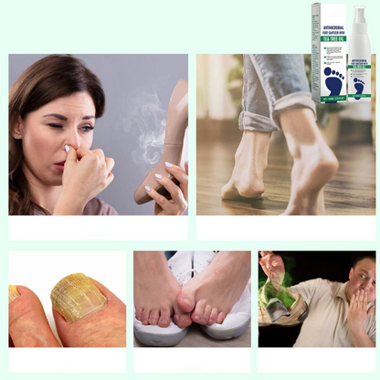 FootCare™ Antimicrobiële Voetspray – Diepe Hydratatie & Voetverzorging [1+1 Gratis]