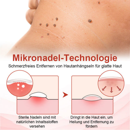 Odalit™ - Pijnloze verwijdering van huidincisies [1 + 1 Gratis]