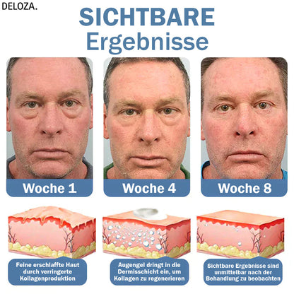EyeRenew™ – Stralende & jeugdige oogverzorging voor wakkere, gladde huid [50% Korting]