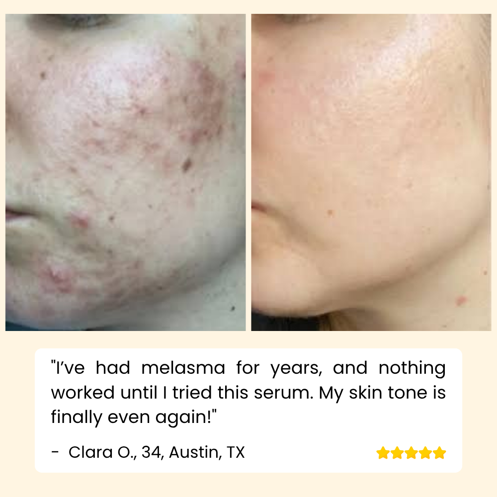 Eelhoe™ – Eternity Vitamin C Serum voor gezicht, handen & lichaam voor stralende huid [1 + 1 Gratis]