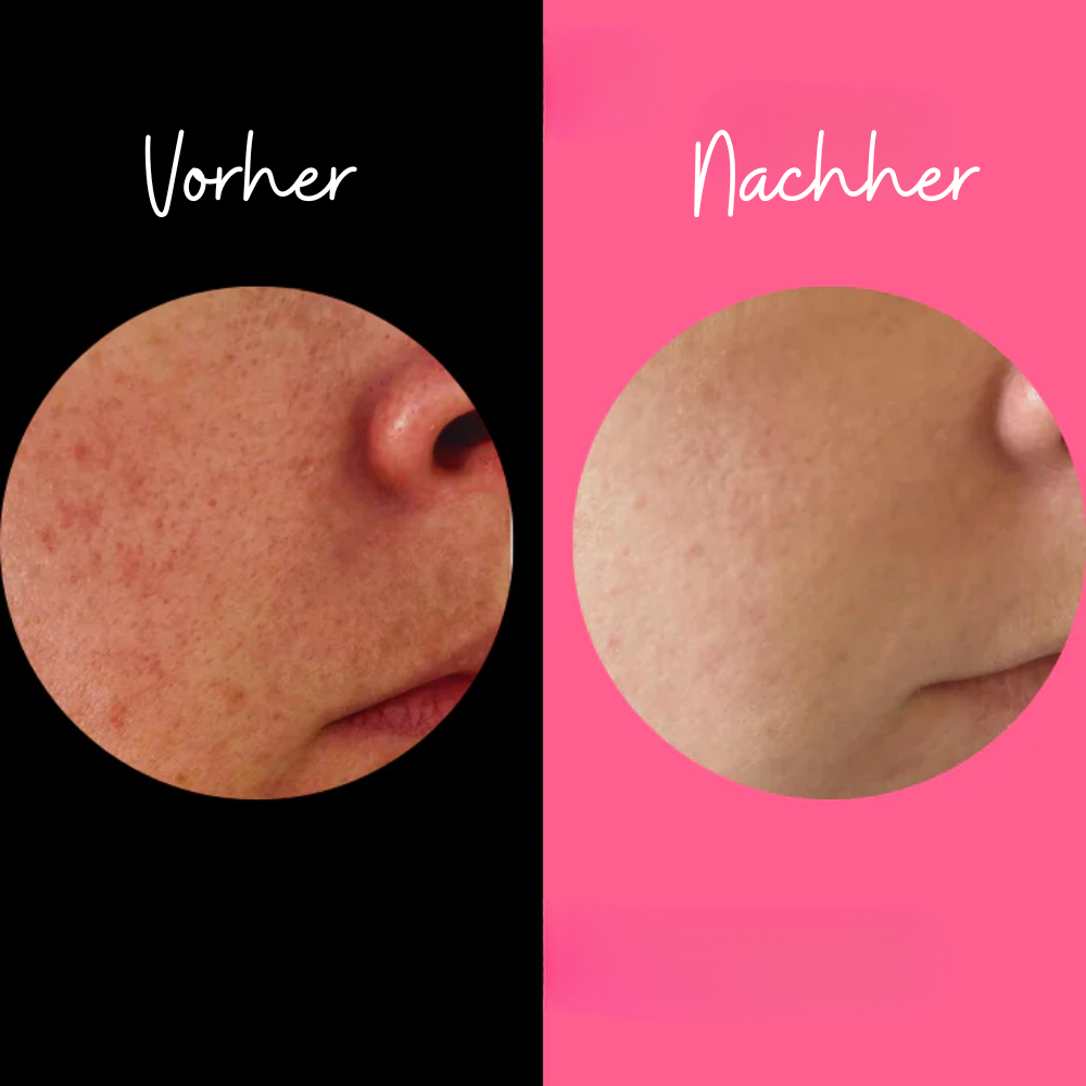RadiantSkin – Peelingsponge voor een natuurlijk stralende huid 1 + 1 Gratis