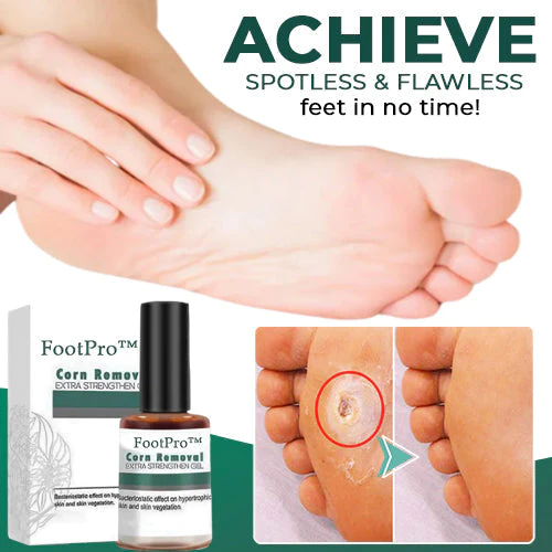 FootPro™ - Likdoornverwijdering Extra Sterke Gel [1 + 1 Gratis]