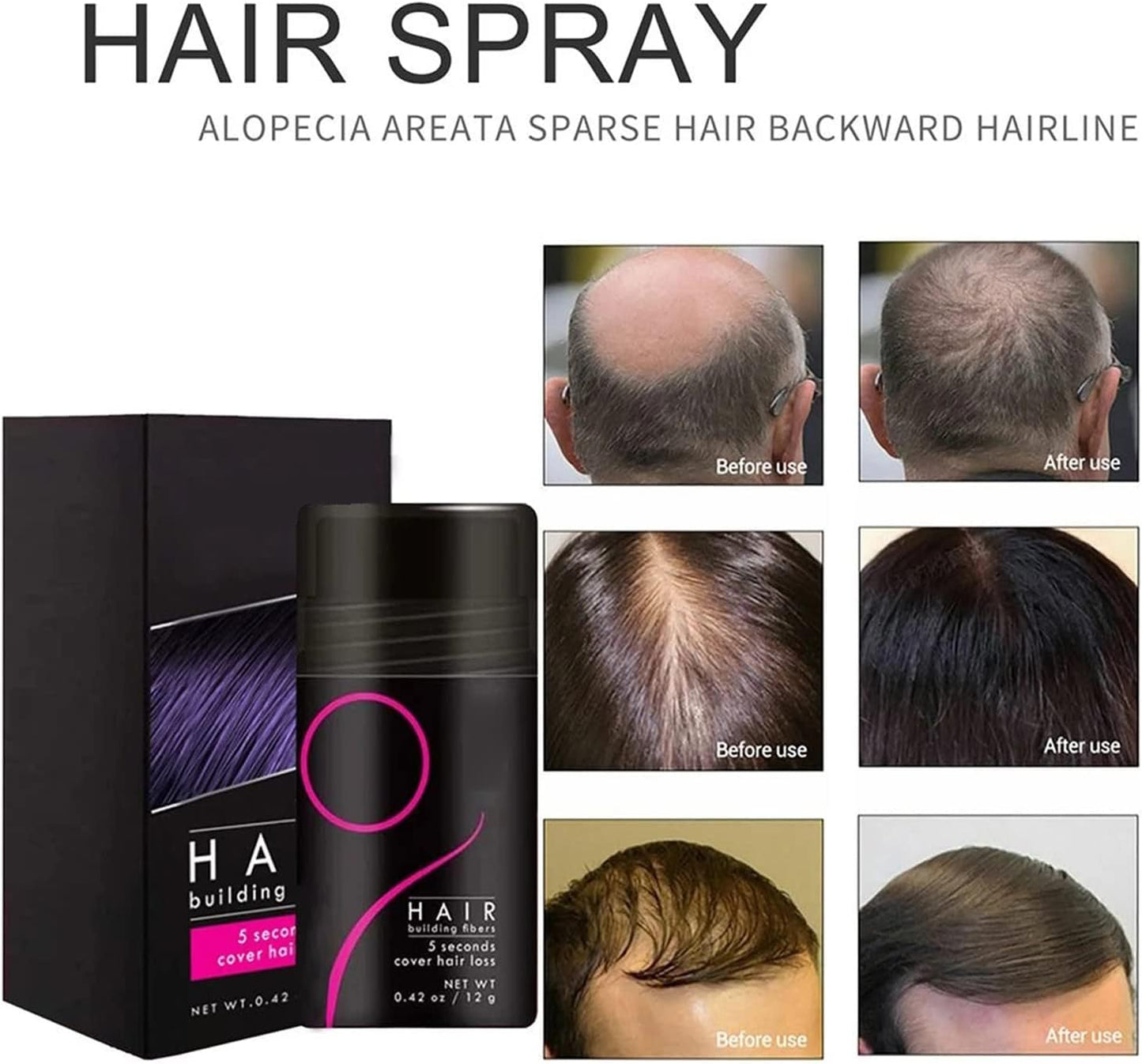 FluffUp™ Haarvezels – Direct Voller Haar & Kaalheid Camoufleren