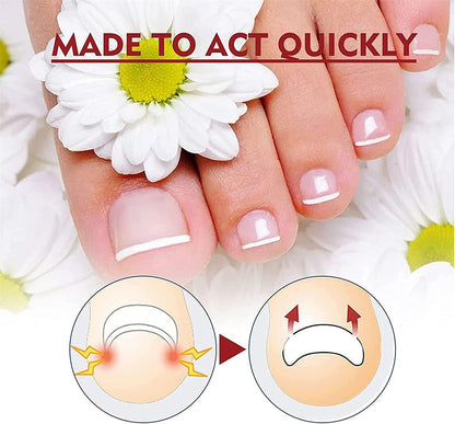 HeilungsTropfen™ – Beschadigde & Broze Nagels Herstellen in 4 Weken [1+1 Gratis]