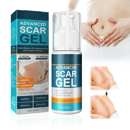 ScarAway™ – Geavanceerde littekenverwijderingsgel voor een gladde huid [1 + 1 Gratis]