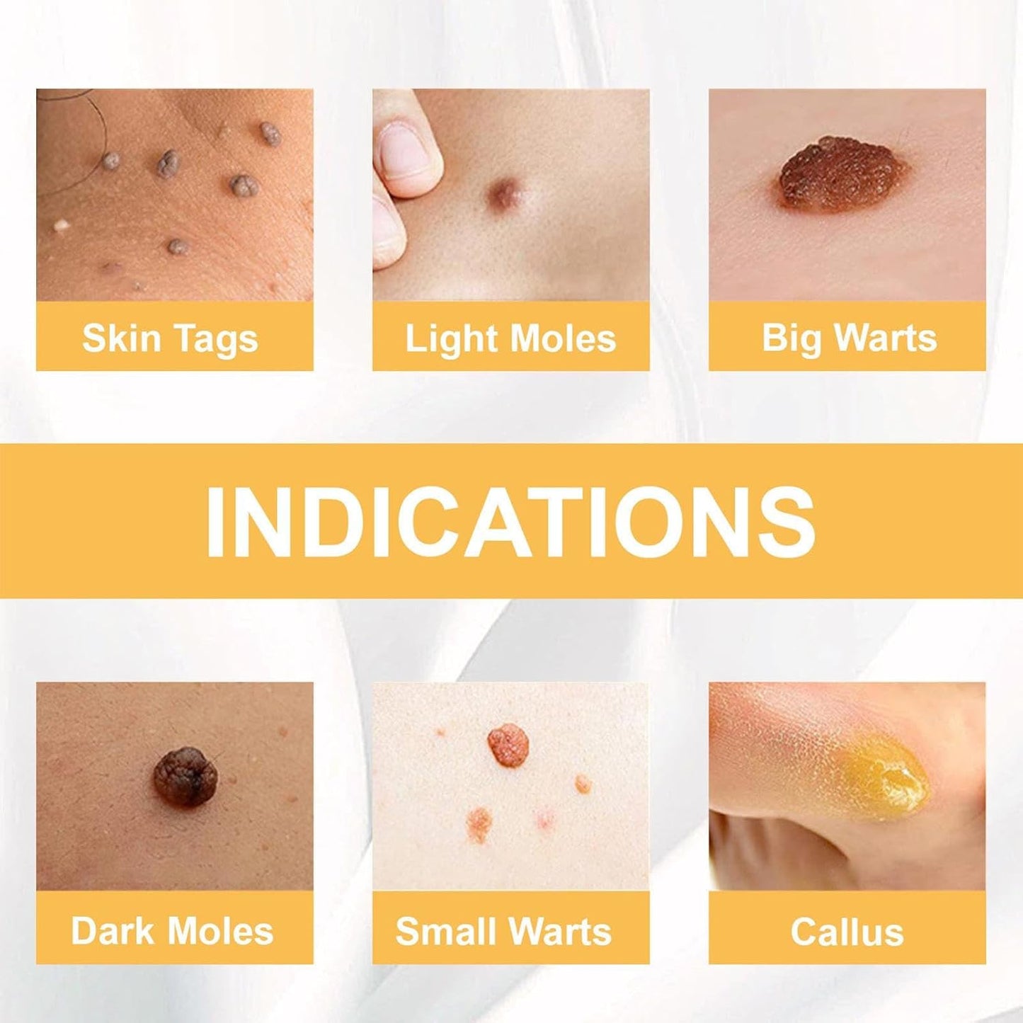 PureDerm™ - Snelwerkende formule Voor een vlekkeloze huid zonder vlekken! [1 + 1 Gratis]