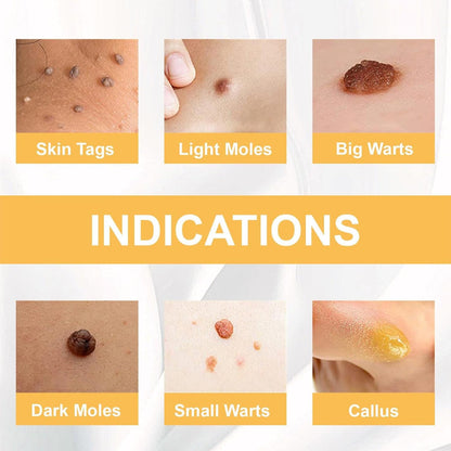 PureDerm™ - Snelwerkende formule Voor een vlekkeloze huid zonder vlekken! [1 + 1 Gratis]