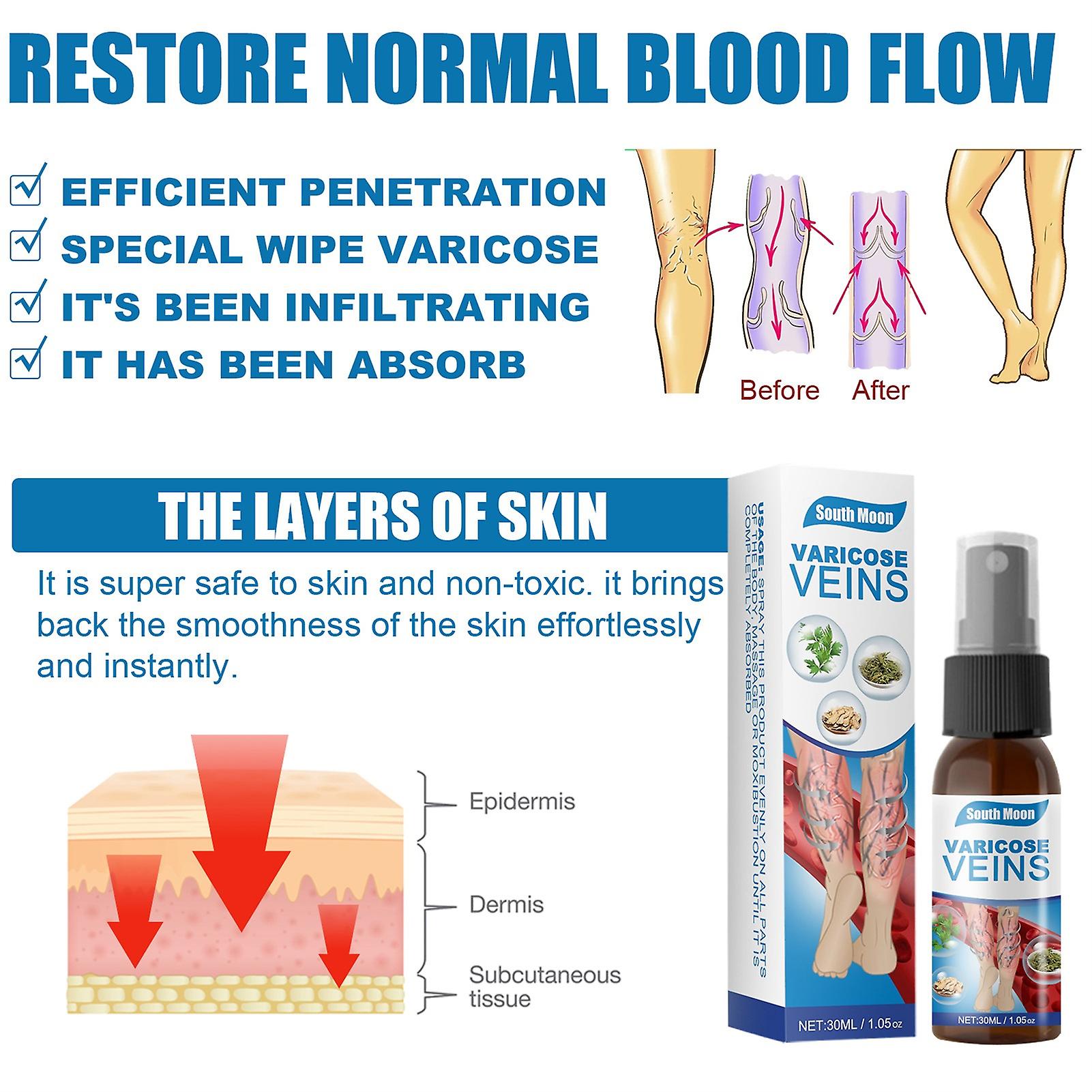 VeinSpray™ - Spataderen behandelen zonder operatie! [1 + 1 Gratis]