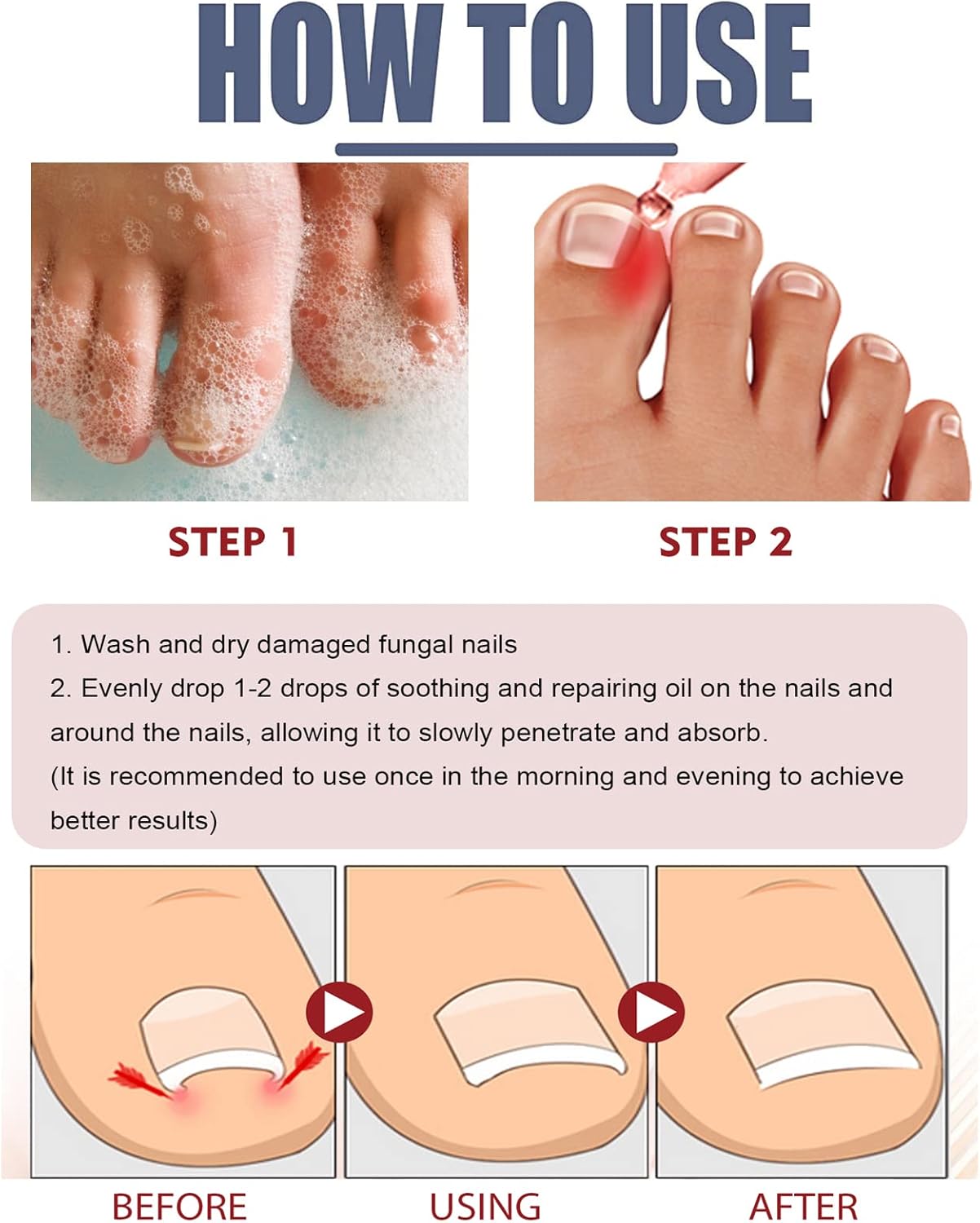 ToePerfect™ Nagelserum – Intensieve Verzorging voor Teen- & Handnagels [1+1 Gratis]