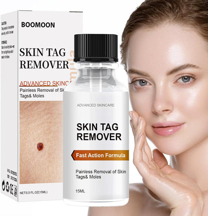 PureDerm™ - Snelwerkende formule Voor een vlekkeloze huid zonder vlekken! [1 + 1 Gratis]