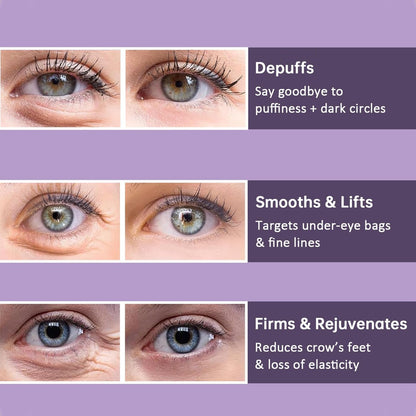 InstantLift™ – Verstevigende anti-aging oogcrème tegen rimpels, wallen & donkere kringen [50% Korting]