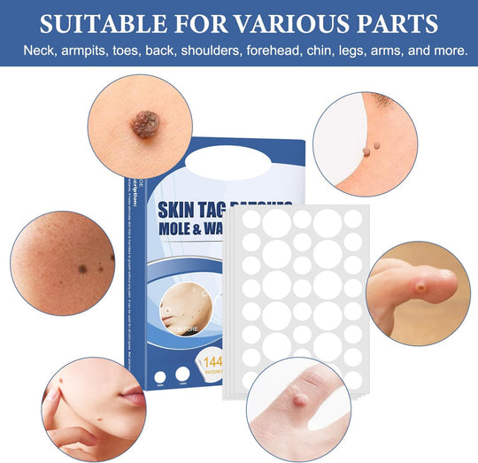 SkinPatch™ – Pijnloze, niet-invasieve behandeling voor zichtbaar heldere, gezonde huid [1 + 1 Gratis]