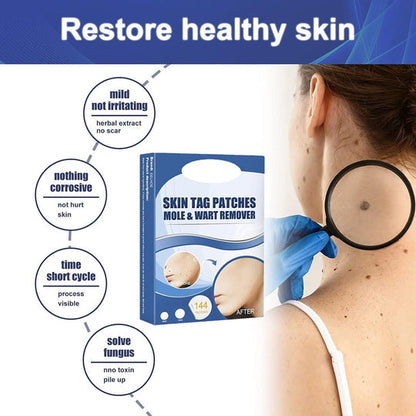 SkinPatch™ – Pijnloze, niet-invasieve behandeling voor zichtbaar heldere, gezonde huid [1 + 1 Gratis]