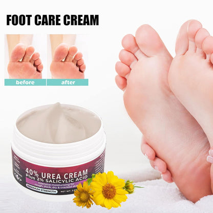 FootCream™ – Helende en beschermende verzorging voor gebarsten huid, voor langdurig comfort [1 + 1 Gratis]