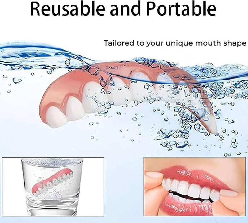 SmileWhite™ - Gebitsprothese set - Zeg vaarwel tegen gebitsprothese ongemak! [50% Korting]