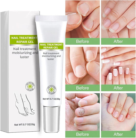 RejuveNail™ – Versterkt je nagels voor een gezonde & mooie uitstraling [1 + 1 Gratis]