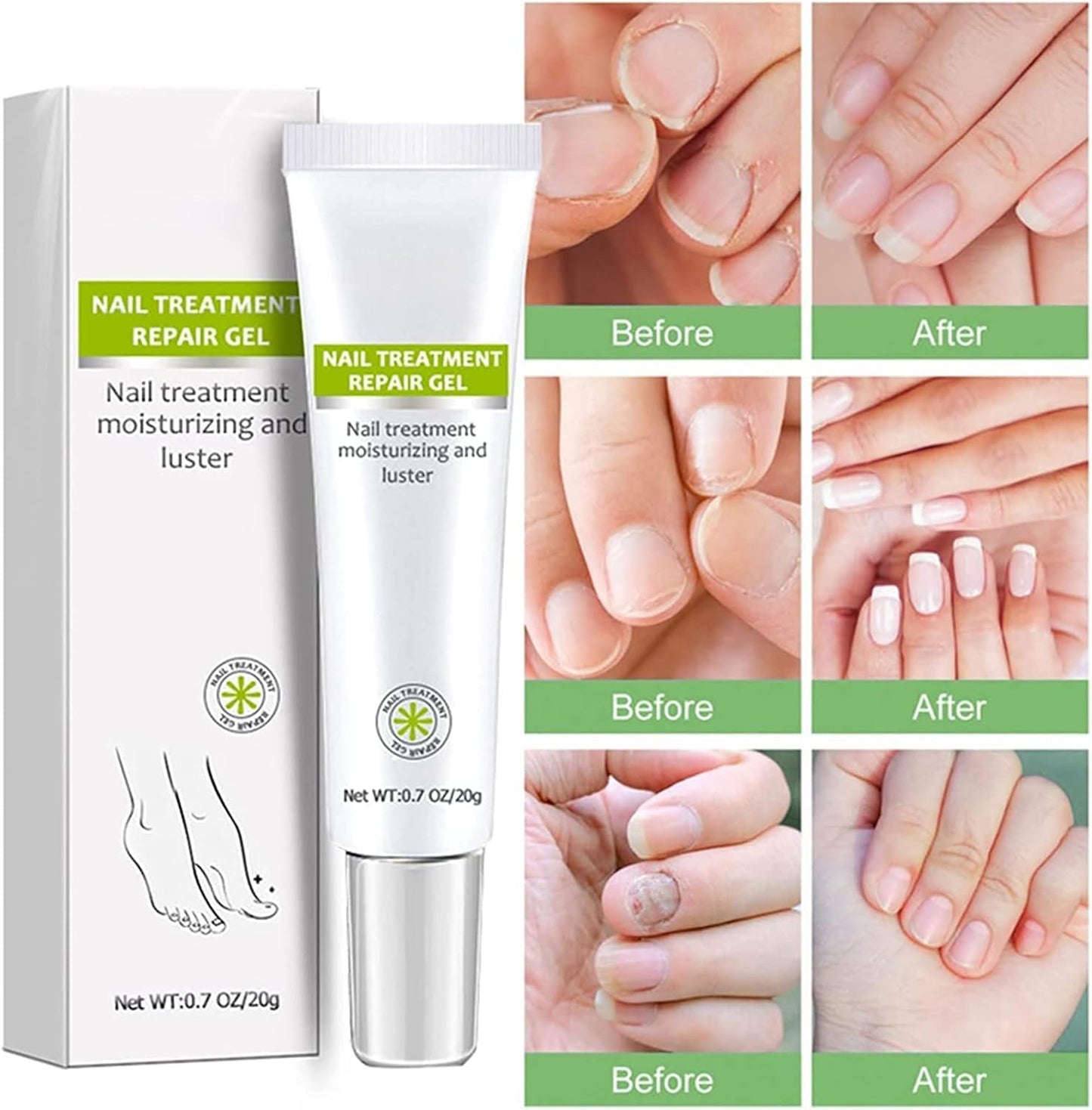 RejuveNail™ – Versterkt Duurzaam Gezonde, Mooie Nagels [1 + 1 Gratis]