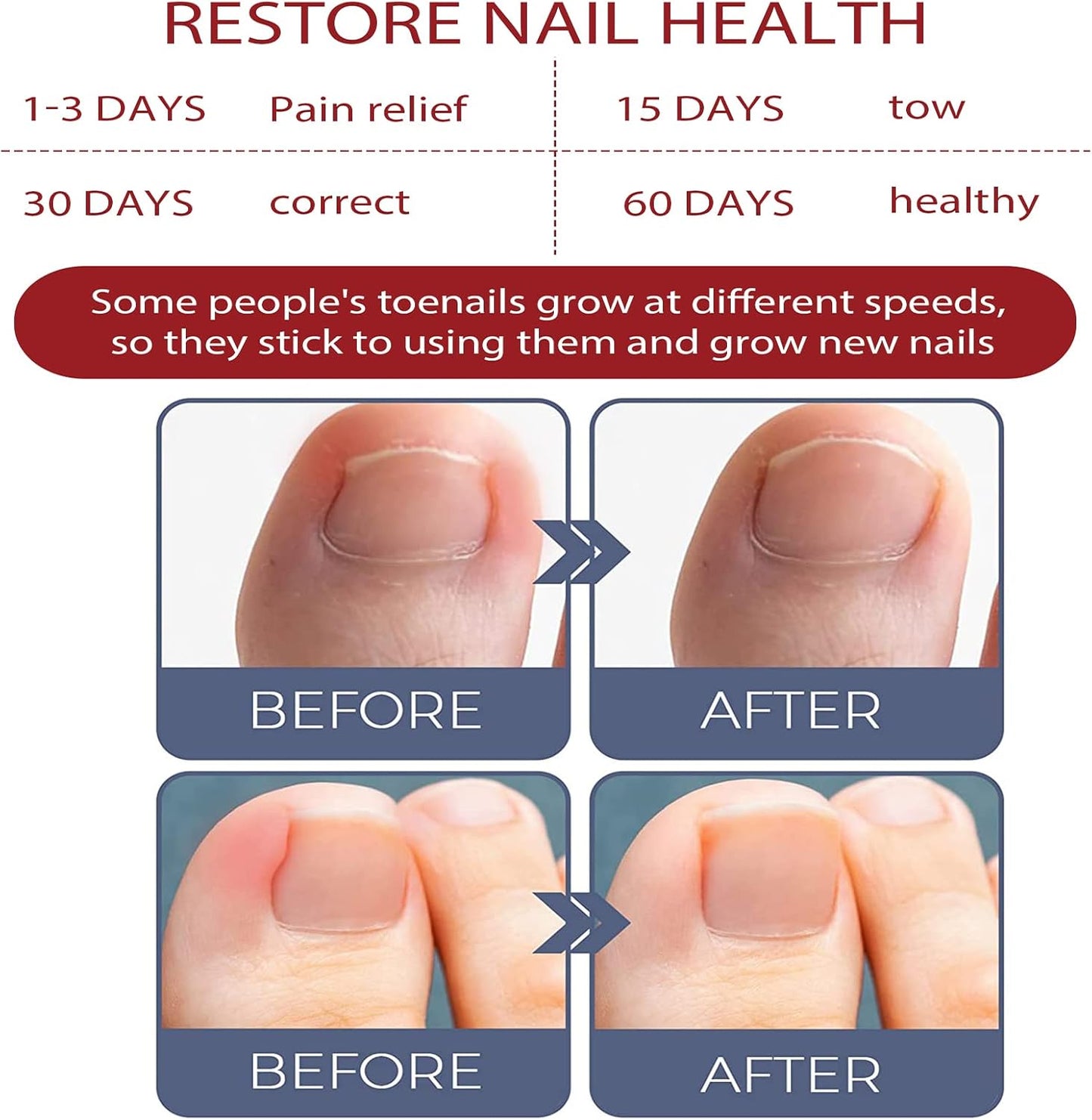 ToePerfect™ Nagelserum – Intensieve Verzorging voor Teen- & Handnagels [1+1 Gratis]