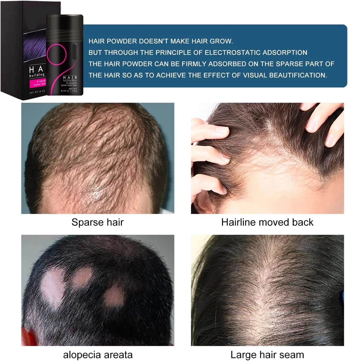 FluffUp™ Haarvezels – Direct Voller Haar & Kaalheid Camoufleren