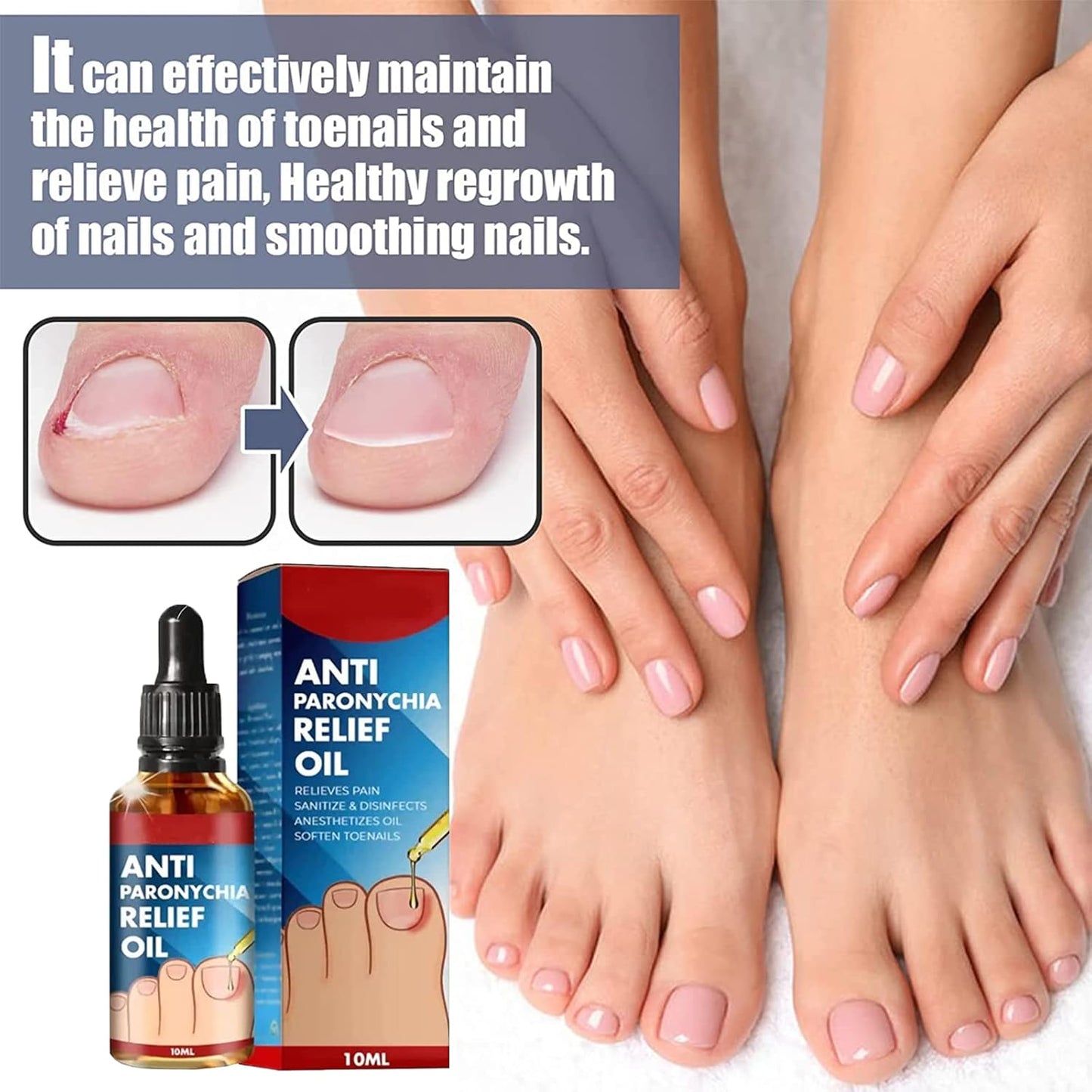 ToePerfect™ Nagelserum – Intensieve Verzorging voor Teen- & Handnagels [1+1 Gratis]